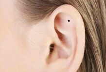 nốt ruồi trong vành tai